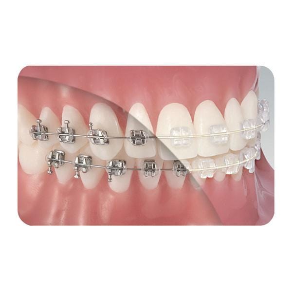 ARCHI TOOTH TONE® ESTETICI FULL FORM A SEZIONE RETTANGOLARE - Superiore .016" x .022"
