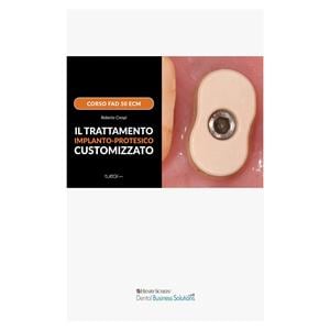 Trattamento implanto-protesico customizzato - Business Solutions